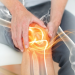 Best Supplements for Arthritis in 2026: A Science-Backed Guide to Joint Pain Relief Arthritis knee joint inflammation and pain visualization